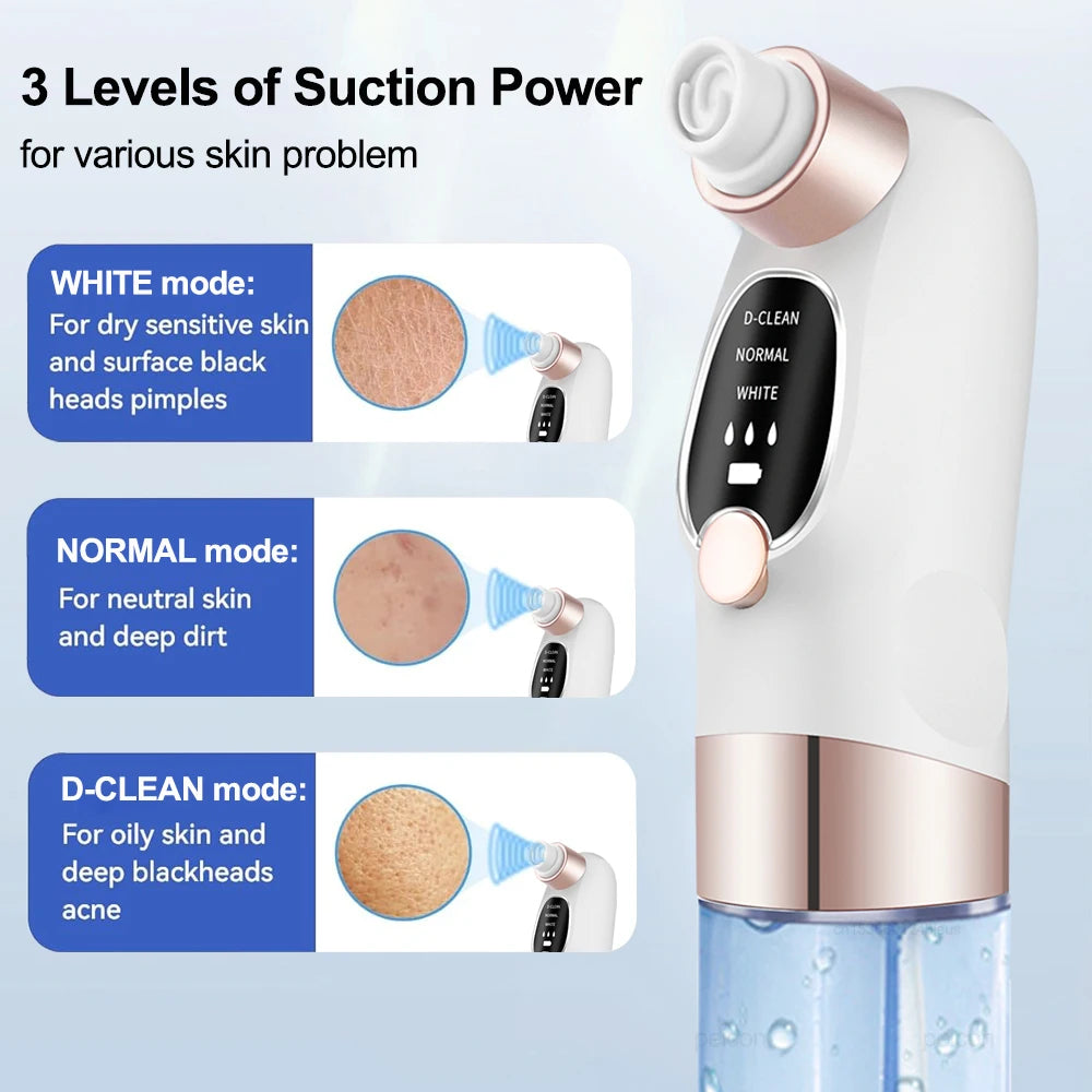 ORAVYN Blackhead Remover Vacuum