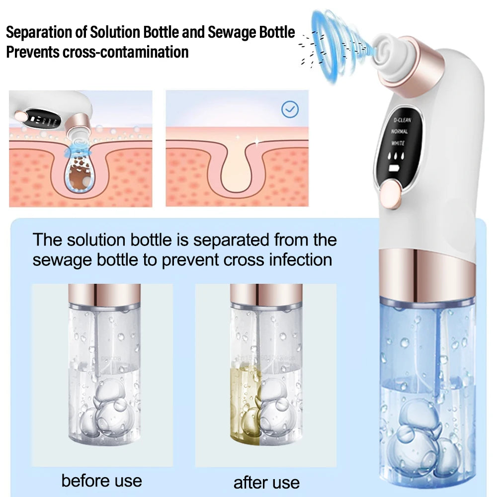 ORAVYN Blackhead Remover Vacuum