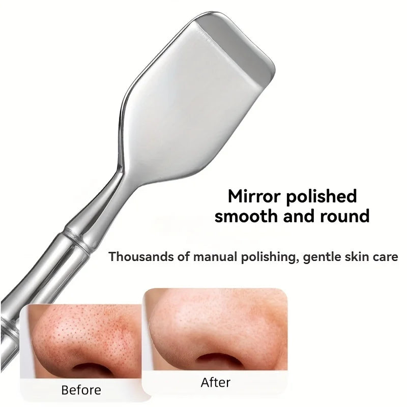 ORAVYN Blackhead Remover Tool for Clearer, Smoother-Looking Skin